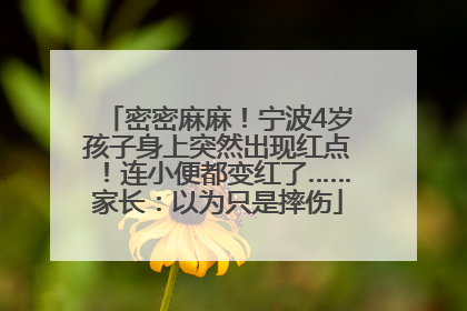 密密麻麻！宁波4岁孩子身上突然出现红点！连小便都变红了……家长：以为只是摔伤
